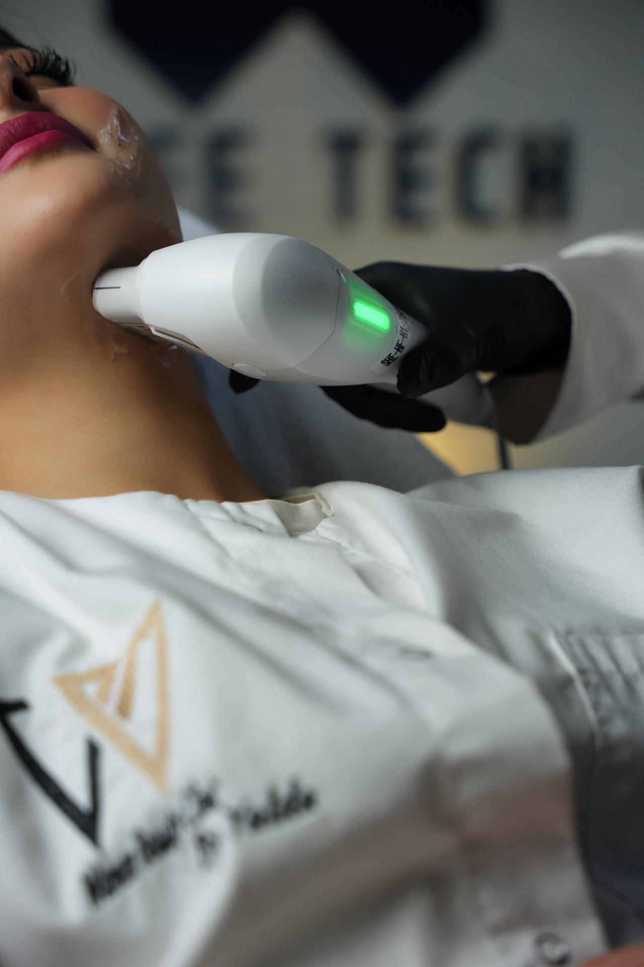 HIFU behandeling bij Wamee Beauty Clinic